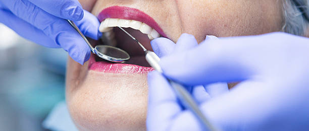 Best Emergency Care for Gum Disease in Port Allen, LA